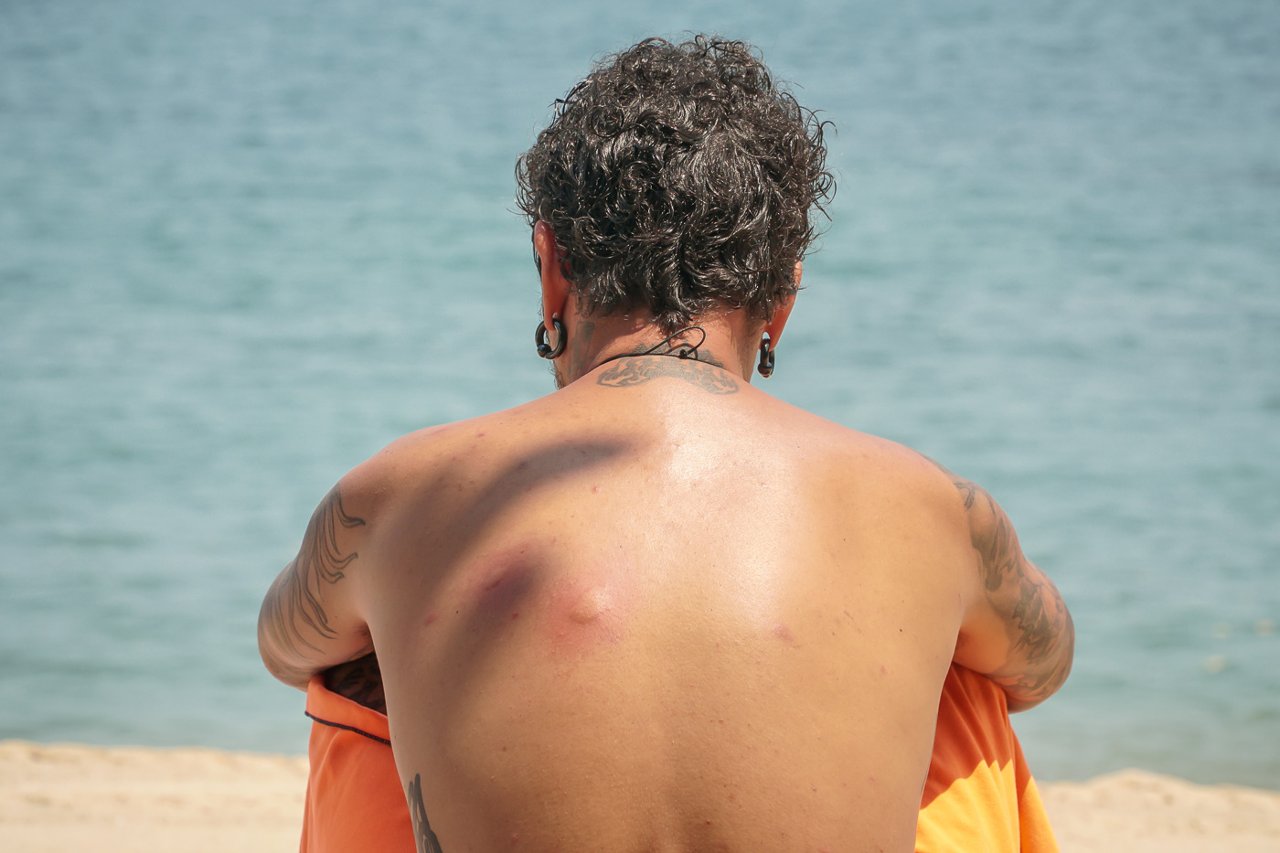 The back of a man with a large red stung